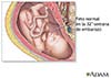 semana 32 embarazo