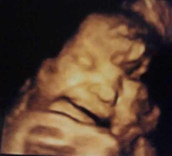 ecografía 36 semanas de embarazo