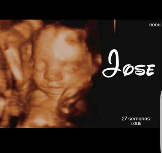 eco jose 27 semanas