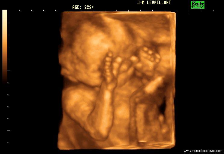 feto-19-semanas