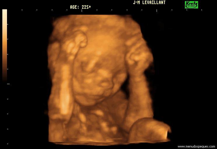 feto-21-semanas