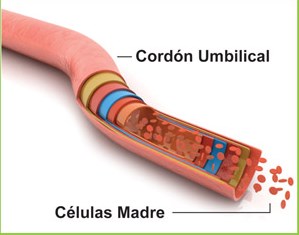 Donación de sangre de cordón umbilical