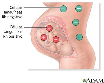 Factor Rh y embarazo