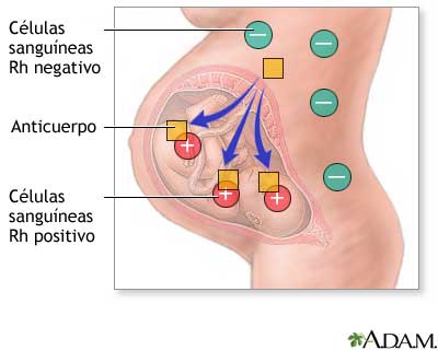 Factor Rh y embarazo