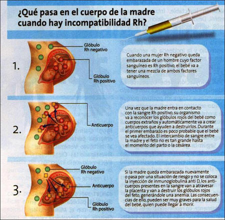 Factor Rh y embarazo