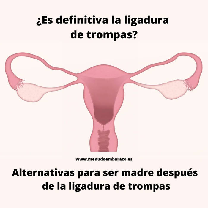 ligadura trompas reversión, posibilidad de embarazo después de la ligadura de trompas