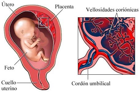 ¿Cómo se realiza el muestreo de vellosidades coriónicas?  ¿Cuándo se pide muestra de vellosidades coriónicas?