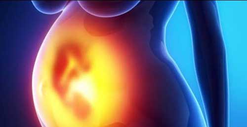 Placenta Previa, Causas, Síntomas y Tipos
