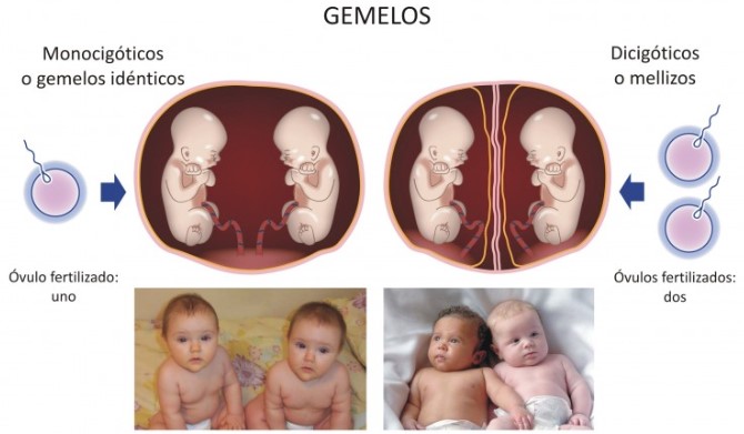 tipos de gemelos